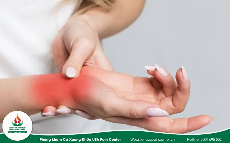 Bệnh ngón tay lò xo có liên quan tới bệnh nào khác không?