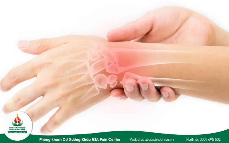 Điều trị ngón tay lò xo tại USA Pain Center có nhanh phục hồi không?