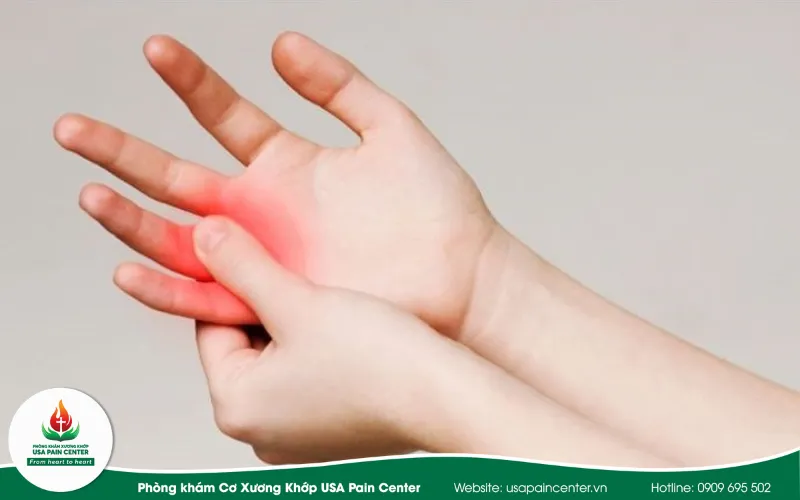 Một số phương pháp phòng ngừa bệnh ngón tay lò xo và cách điều trị