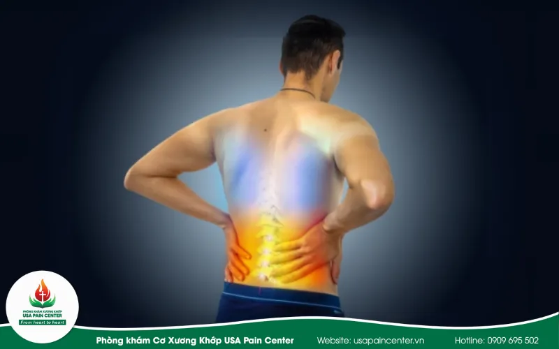 Phác đồ trị liệu đau THẮT lưng khi chơi thể thao
