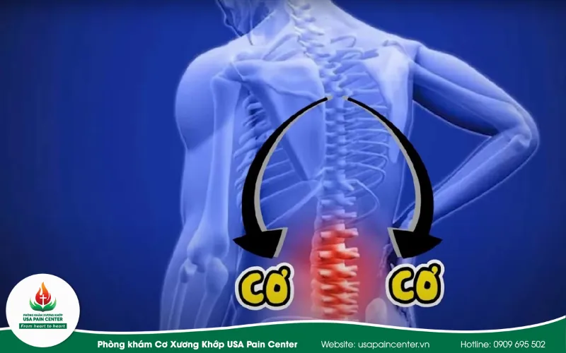 Phòng ngừa đau lưng khi chơi pickleball bằng cách nào