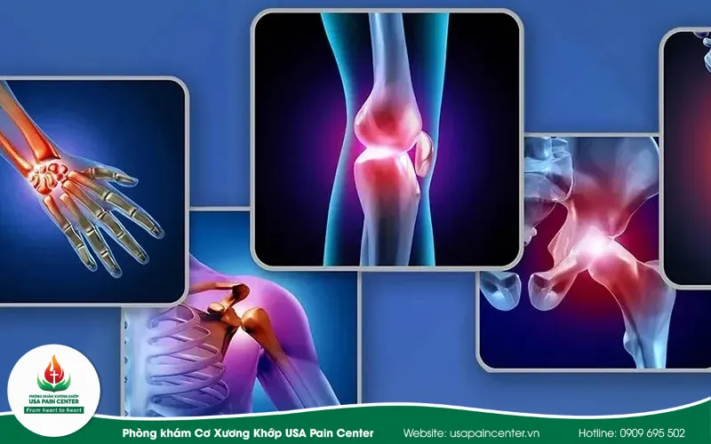 Khi khớp gối kêu lục cục là bệnh gì?