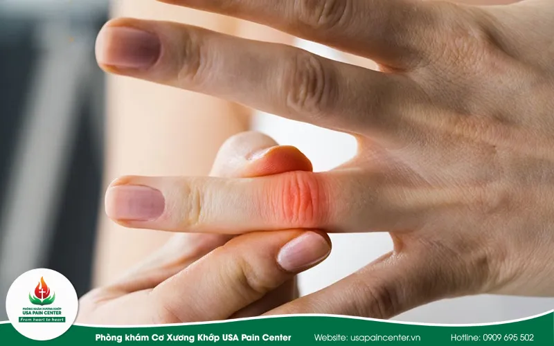 Ngón tay bị đau có tự điều trị tại nhà được không? Lời khuyên chuẩn y khoa