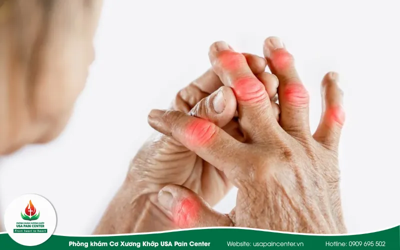 Nguyên nhân phổ biến gây đau ngón tay
