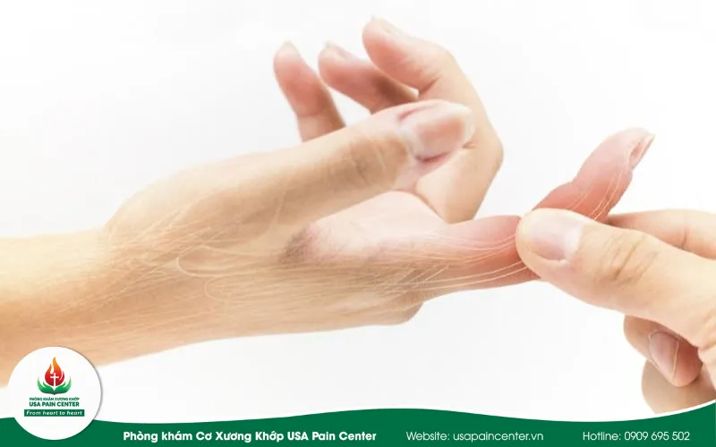 Phương pháp mổ hở tách bao gân ngón tay lò xo là gì?