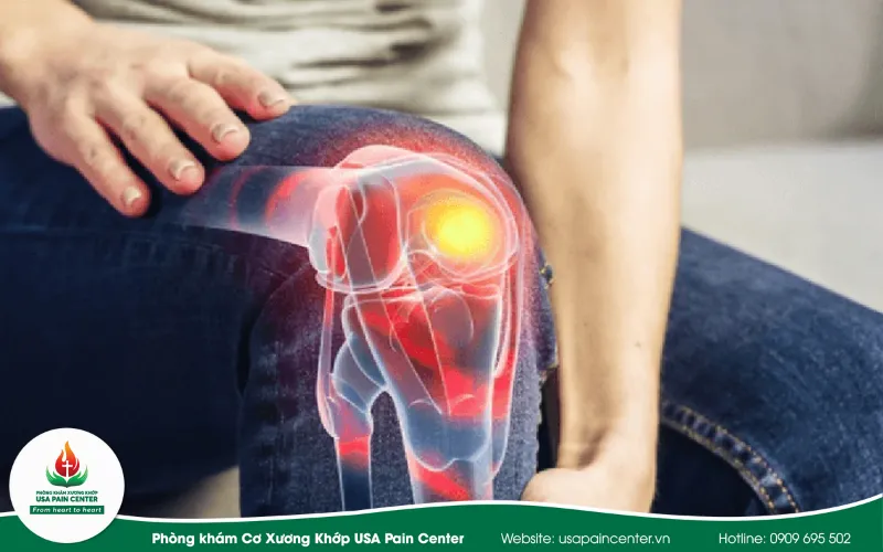 Phục Hồi Chức Năng Thoái Hóa Khớp Gối: Bài Tập & Phác Đồ Y Khoa Tối Ưu