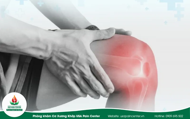 Hướng dẫn phân loại điều trị theo 4 mức độ thoái hóa